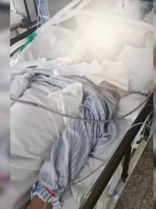 悲痛！水电工人被射钉枪击中头部身亡，那个钉子直接穿到脑袋里面了